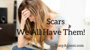 Scars- We All Have Them!